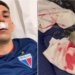 Ônibus do Fortaleza é apedrejado, seis jogadores foram atingidos