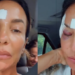 Ivete Sangalo recebe alta de hospital em Salvador após acidente e fala sobre diagnóstico